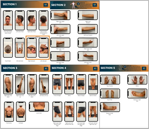 skin image