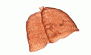 CT Lung