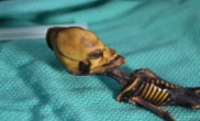 Once-Mysterious ‘Atacama Skeleton’ Illuminates Genetics of Bone Disease