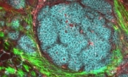 Gene Mapping Lays Groundwork for Precision Chemotherapy