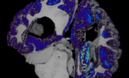 Mapping the human brain to combat Alzheimer's